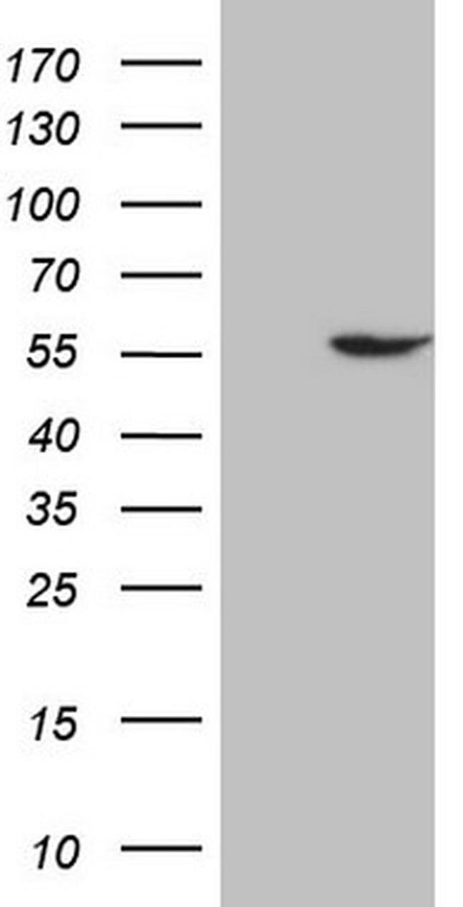 ABAT Antibody in Western Blot (WB)