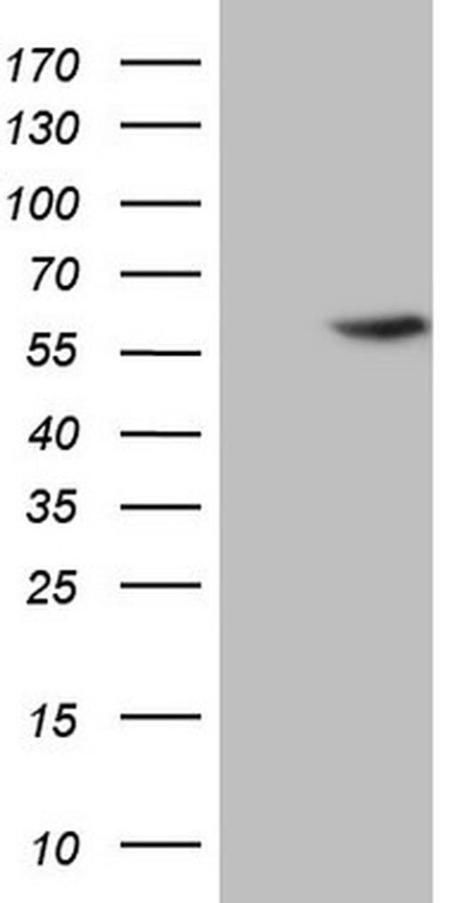 ABAT Antibody in Western Blot (WB)