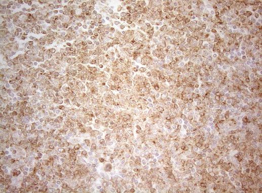 ALOX5 Antibody in Immunohistochemistry (Paraffin) (IHC (P))