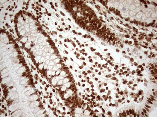 ALOX5 Antibody in Immunohistochemistry (Paraffin) (IHC (P))