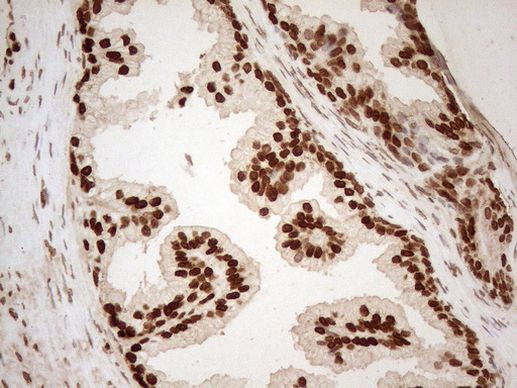 ALOX5 Antibody in Immunohistochemistry (Paraffin) (IHC (P))