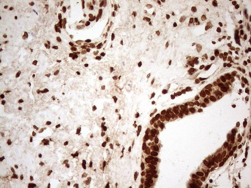 ALOX5 Antibody in Immunohistochemistry (Paraffin) (IHC (P))