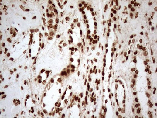 ALOX5 Antibody in Immunohistochemistry (Paraffin) (IHC (P))