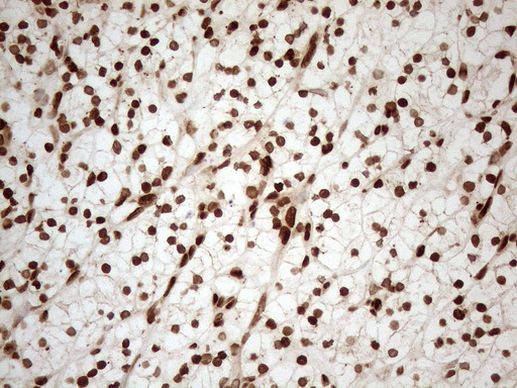 ALOX5 Antibody in Immunohistochemistry (Paraffin) (IHC (P))