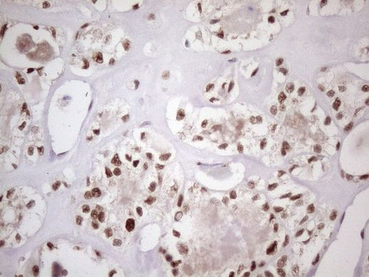 53BP1 Antibody in Immunohistochemistry (Paraffin) (IHC (P))