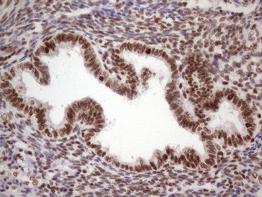 53BP1 Antibody in Immunohistochemistry (Paraffin) (IHC (P))