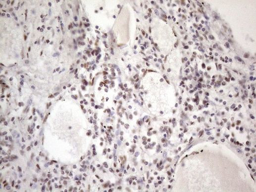 53BP1 Antibody in Immunohistochemistry (Paraffin) (IHC (P))