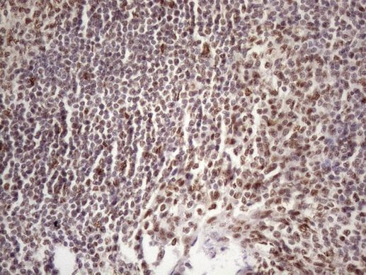 53BP1 Antibody in Immunohistochemistry (Paraffin) (IHC (P))