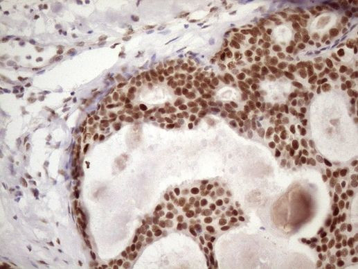 53BP1 Antibody in Immunohistochemistry (Paraffin) (IHC (P))