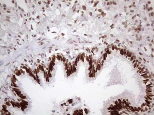 53BP1 Antibody in Immunohistochemistry (Paraffin) (IHC (P))