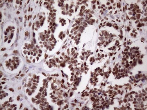 53BP1 Antibody in Immunohistochemistry (Paraffin) (IHC (P))