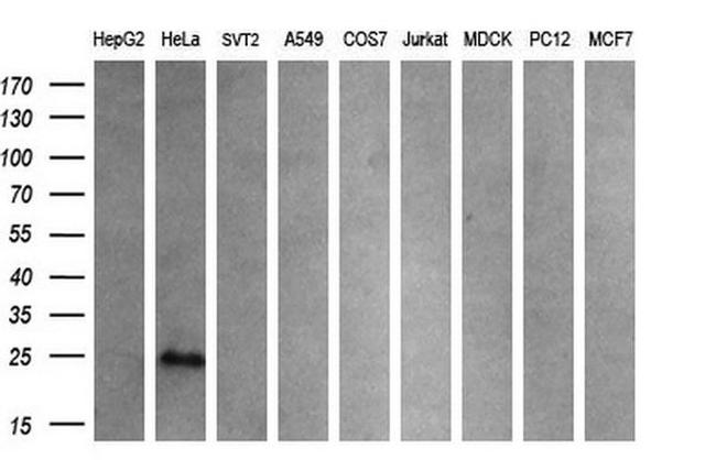 CITED1 Antibody in Western Blot (WB)