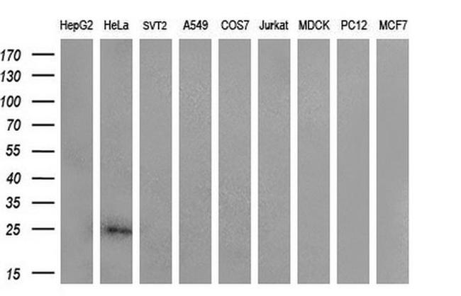 CITED1 Antibody in Western Blot (WB)