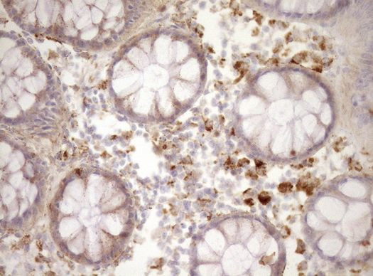 Renin Antibody in Immunohistochemistry (Paraffin) (IHC (P))