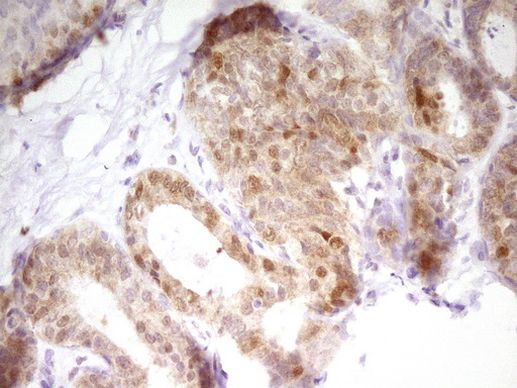 PAPSS2 Antibody in Immunohistochemistry (Paraffin) (IHC (P))