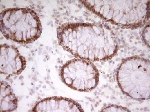 PAPSS2 Antibody in Immunohistochemistry (Paraffin) (IHC (P))