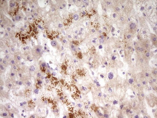 PAPSS2 Antibody in Immunohistochemistry (Paraffin) (IHC (P))