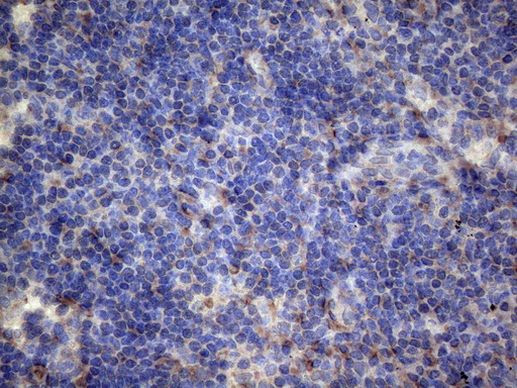 PAPSS2 Antibody in Immunohistochemistry (Paraffin) (IHC (P))