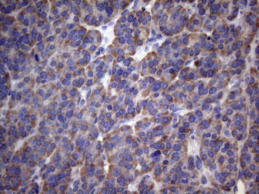 PAPSS2 Antibody in Immunohistochemistry (Paraffin) (IHC (P))