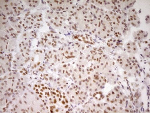 NR2C2 Antibody in Immunohistochemistry (Paraffin) (IHC (P))