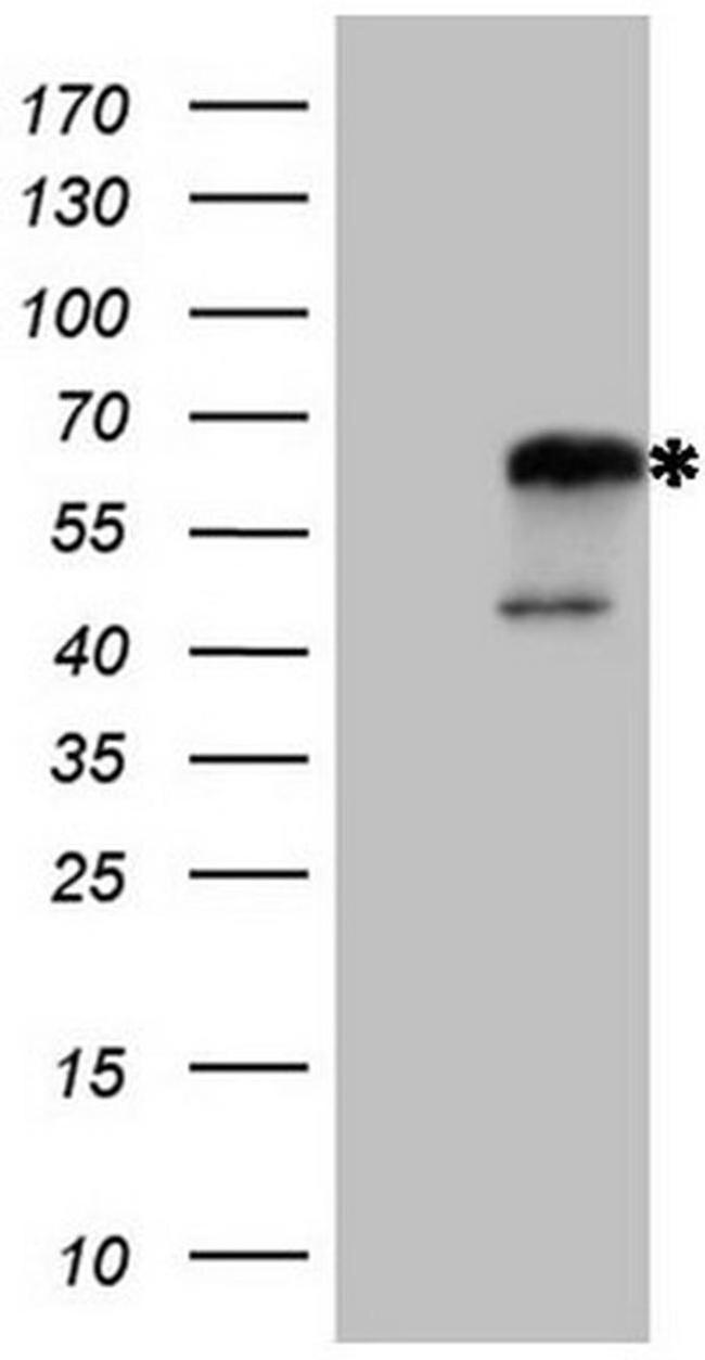 NR2C2 Antibody in Western Blot (WB)