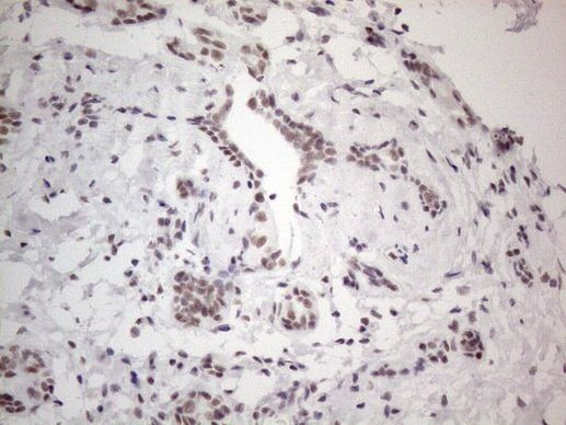 NR2C2 Antibody in Immunohistochemistry (Paraffin) (IHC (P))