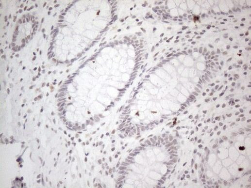 NR2C2 Antibody in Immunohistochemistry (Paraffin) (IHC (P))