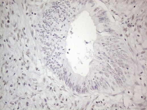 NR2C2 Antibody in Immunohistochemistry (Paraffin) (IHC (P))