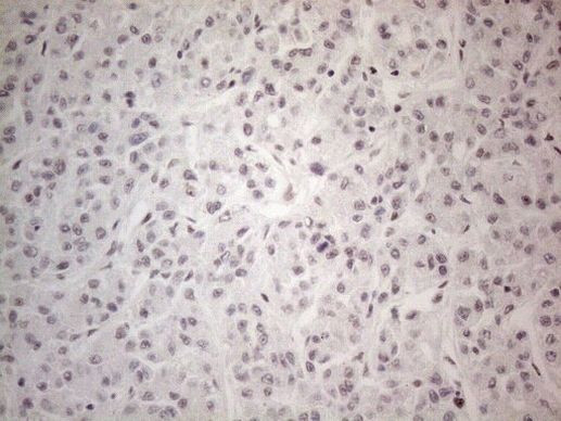 NR2C2 Antibody in Immunohistochemistry (Paraffin) (IHC (P))