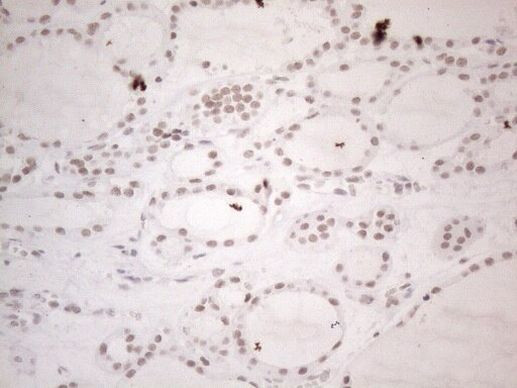 NR2C2 Antibody in Immunohistochemistry (Paraffin) (IHC (P))