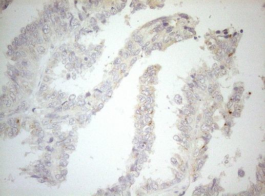 Carboxypeptidase M Antibody in Immunohistochemistry (Paraffin) (IHC (P))