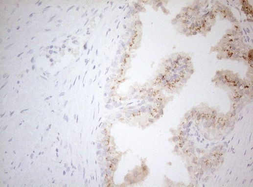 Carboxypeptidase M Antibody in Immunohistochemistry (Paraffin) (IHC (P))