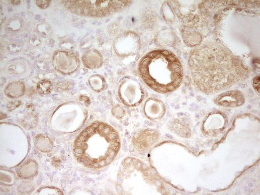 PAK4 Antibody in Immunohistochemistry (Paraffin) (IHC (P))