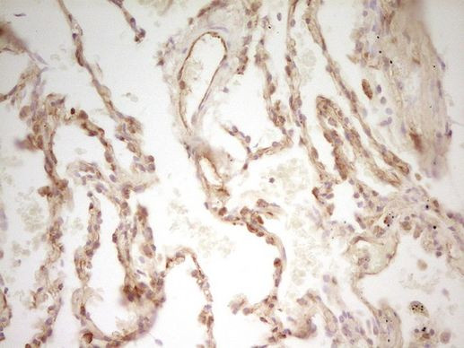 PAK4 Antibody in Immunohistochemistry (Paraffin) (IHC (P))