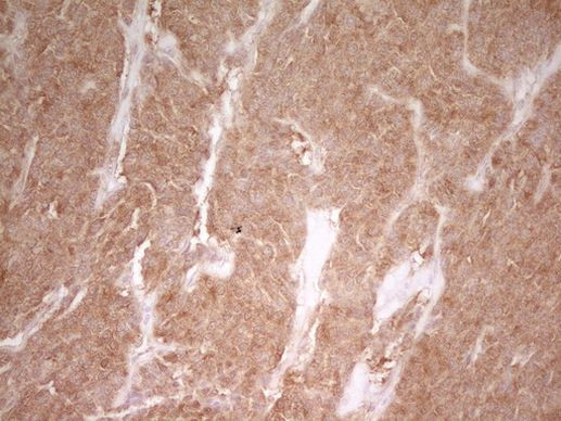 PAK4 Antibody in Immunohistochemistry (Paraffin) (IHC (P))