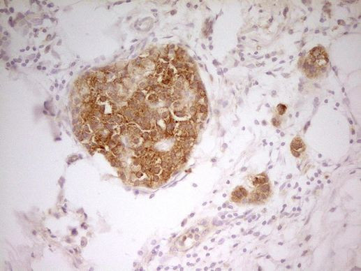 PAK4 Antibody in Immunohistochemistry (Paraffin) (IHC (P))