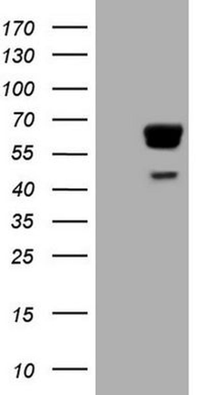 PAK4 Antibody in Western Blot (WB)