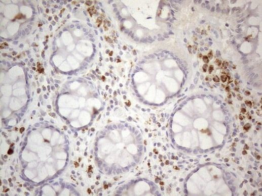 PISD Antibody in Immunohistochemistry (Paraffin) (IHC (P))