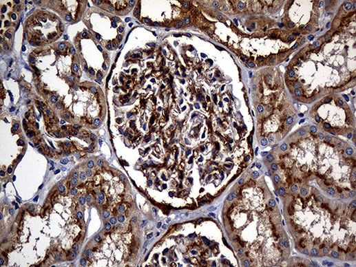 Carboxypeptidase M Antibody in Immunohistochemistry (Paraffin) (IHC (P))