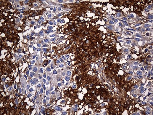 Carboxypeptidase M Antibody in Immunohistochemistry (Paraffin) (IHC (P))