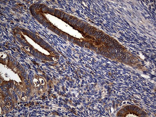 Carboxypeptidase M Antibody in Immunohistochemistry (Paraffin) (IHC (P))