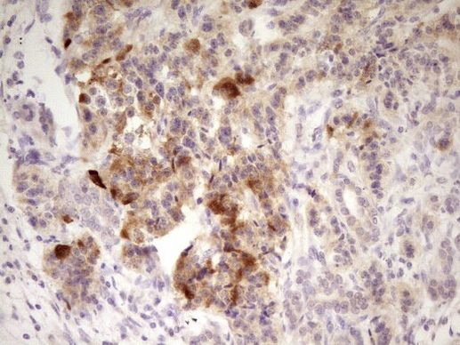 ANGPTL3 Antibody in Immunohistochemistry (Paraffin) (IHC (P))