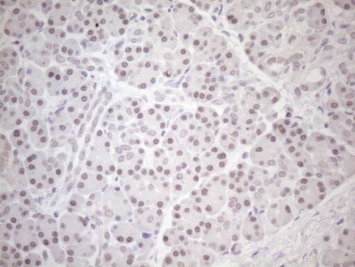 HSF2 Antibody in Immunohistochemistry (Paraffin) (IHC (P))