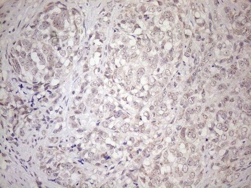 HSF2 Antibody in Immunohistochemistry (Paraffin) (IHC (P))