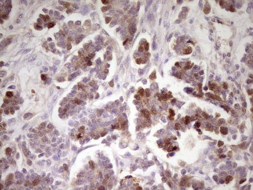 ECT2 Antibody in Immunohistochemistry (Paraffin) (IHC (P))