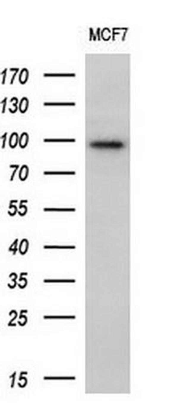 ECT2 Antibody in Western Blot (WB)