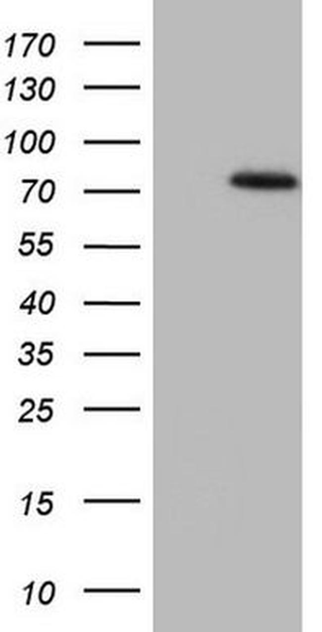 SSX2IP Antibody in Western Blot (WB)