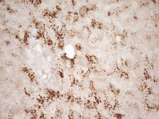 Bmf Antibody in Immunohistochemistry (Paraffin) (IHC (P))