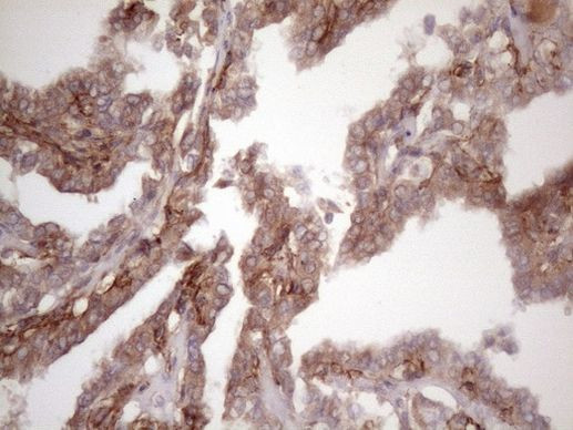 Bmf Antibody in Immunohistochemistry (Paraffin) (IHC (P))