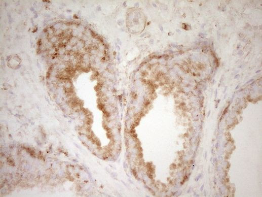 Pellino 1 Antibody in Immunohistochemistry (Paraffin) (IHC (P))